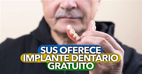 implante dentario|implante dentário gratuito.
